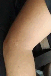 Глибоке проникнення та щоденний догляд при діабетичній нейропатії