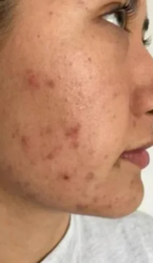 345 Skin зволожувальний та живильний крем