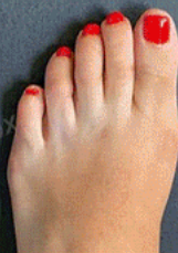 Глибоке проникнення та щоденний догляд при діабетичній нейропатії