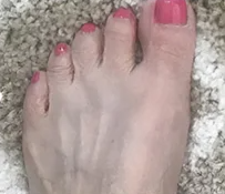 Крем від «кісточки» на великому пальці