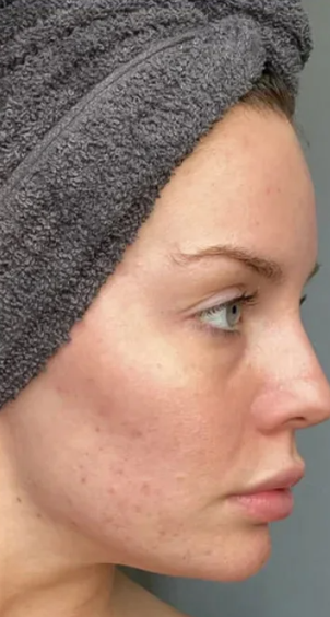 345 Skin зволожувальний та живильний крем